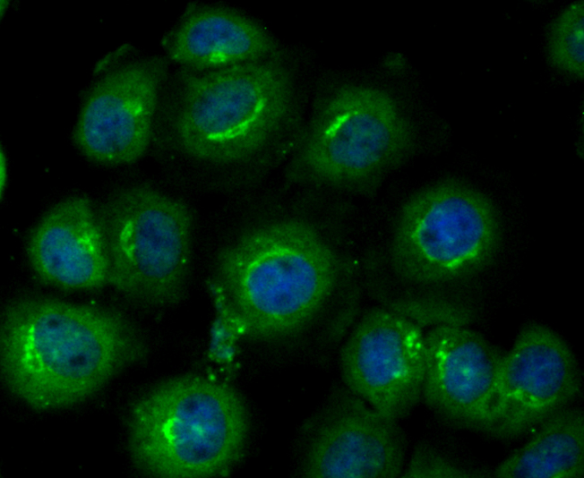 Glucose 6 phosphate isomerase Rabbit mAb