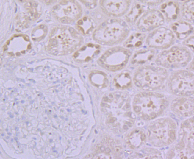 Glucose 6 phosphate isomerase Rabbit mAb