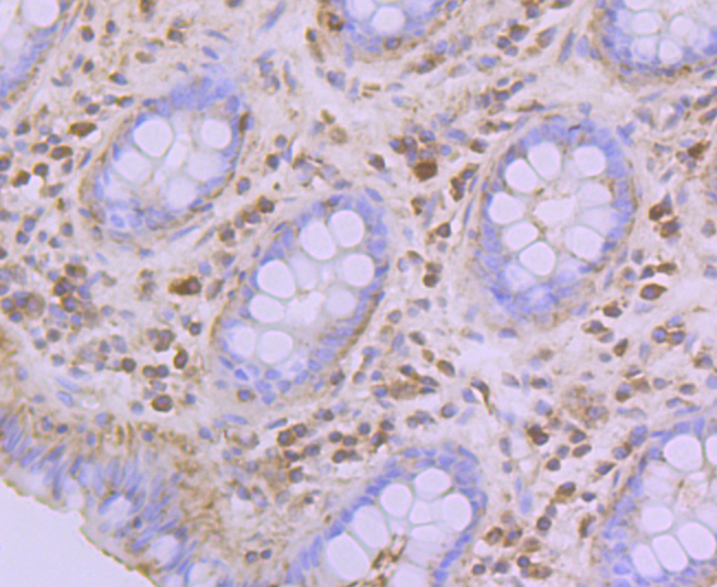 Glucose 6 phosphate isomerase Rabbit mAb