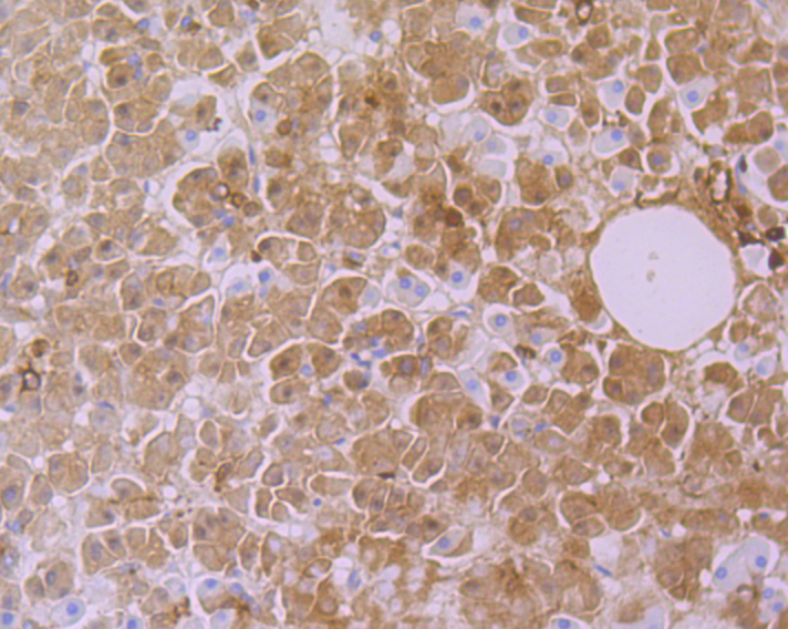 CYP26A1 Rabbit mAb