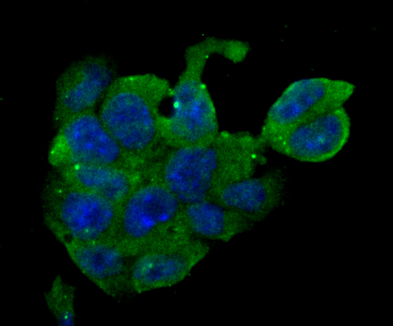 ERp29 Rabbit mAb