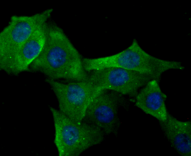 ERp29 Rabbit mAb