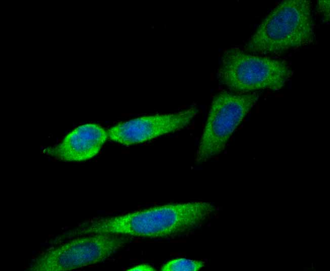 ERp29 Rabbit mAb