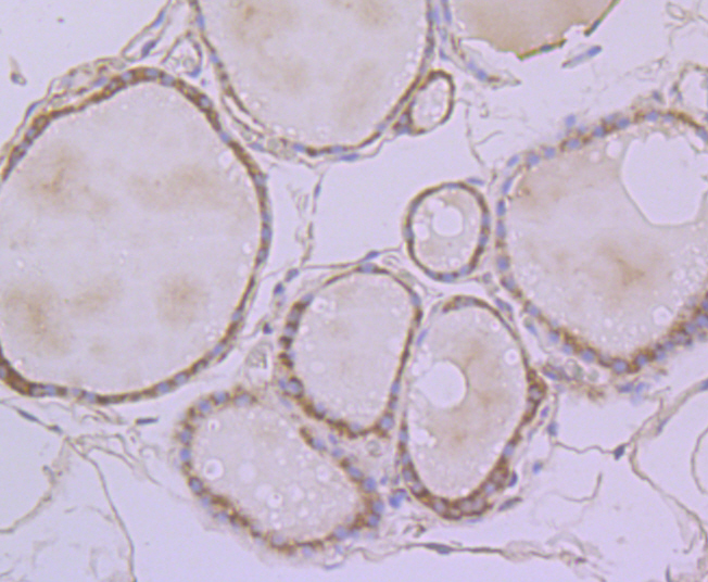 ERp29 Rabbit mAb