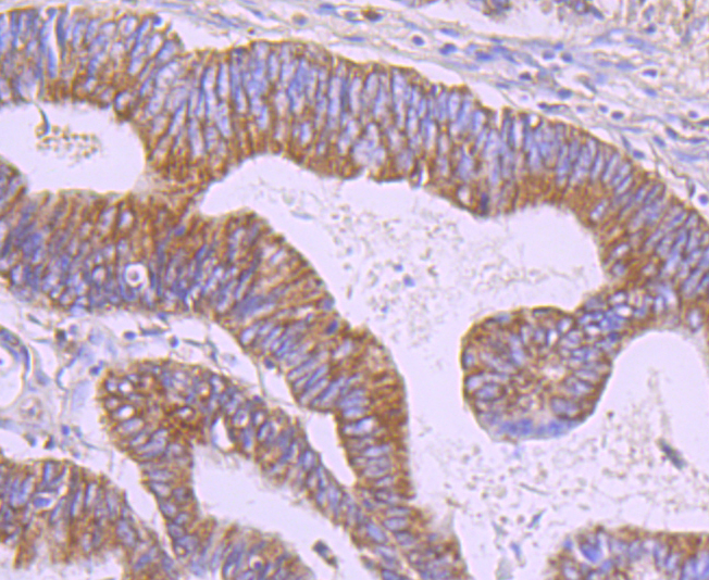 ERp29 Rabbit mAb