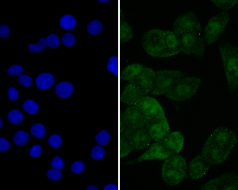 eIF4A3 Rabbit mAb