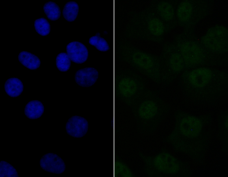 eIF4A3 Rabbit mAb