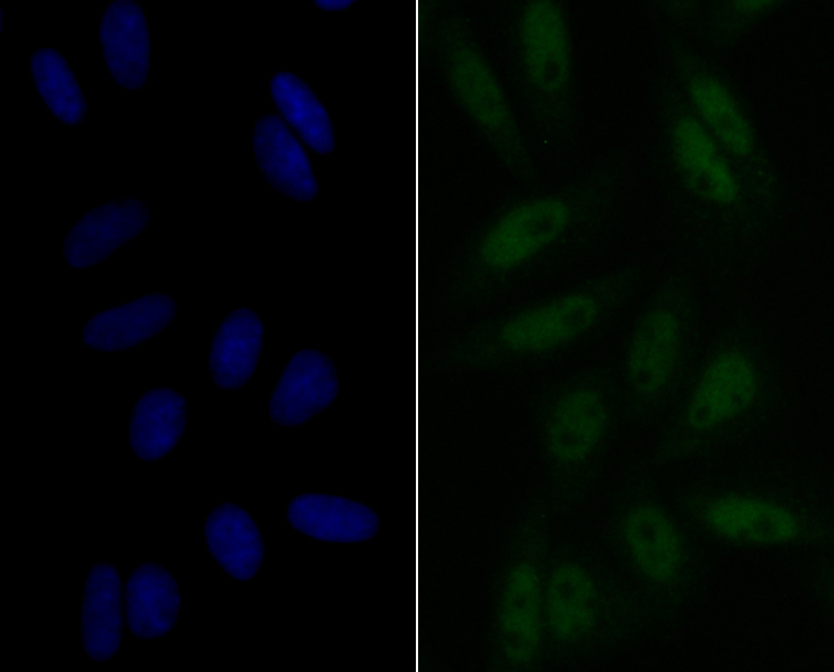 eIF4A3 Rabbit mAb