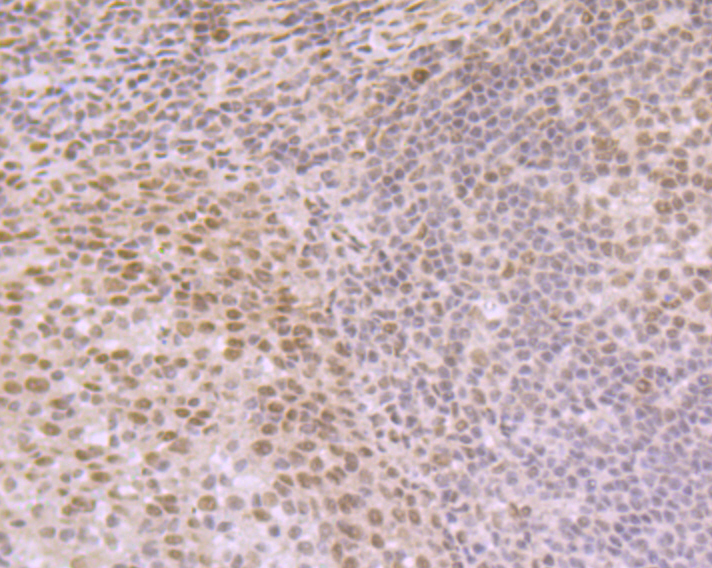 eIF4A3 Rabbit mAb