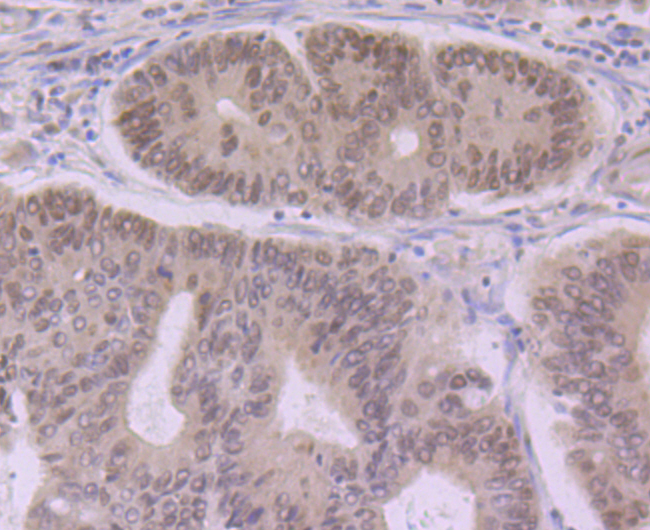 eIF4A3 Rabbit mAb