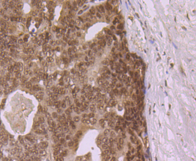 eIF4A3 Rabbit mAb