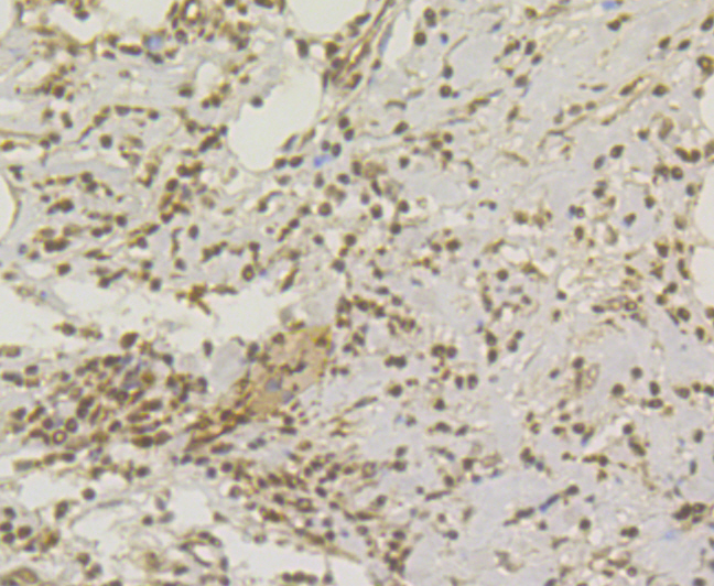 CHD1L Rabbit mAb