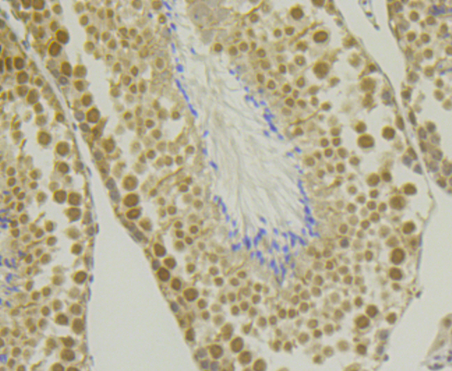 CHD1L Rabbit mAb