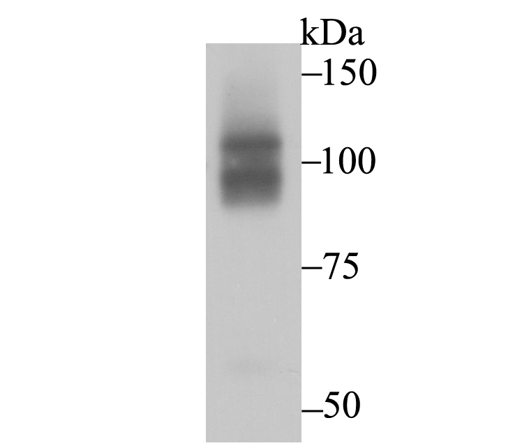 CHD1L Rabbit mAb