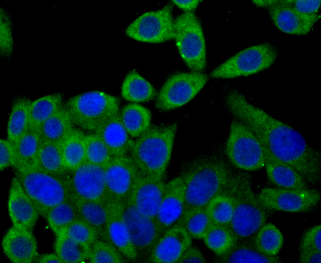 Syntrophin alpha 1 Rabbit mAb