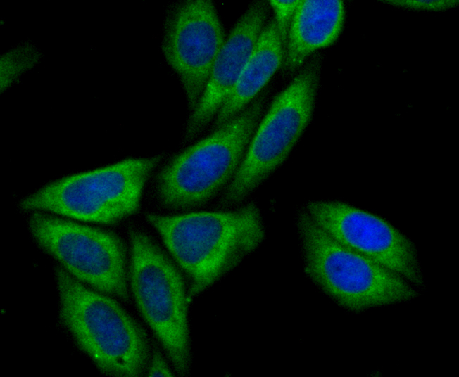 Syntrophin alpha 1 Rabbit mAb