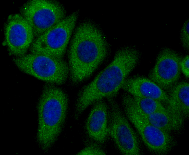 Syntrophin alpha 1 Rabbit mAb