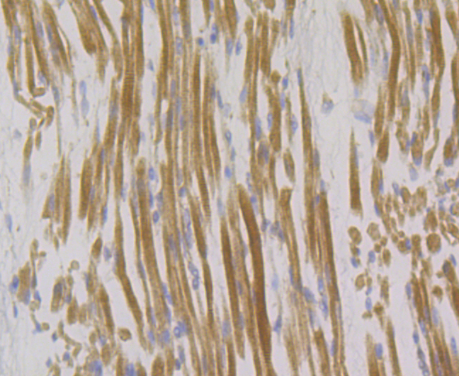 Syntrophin alpha 1 Rabbit mAb