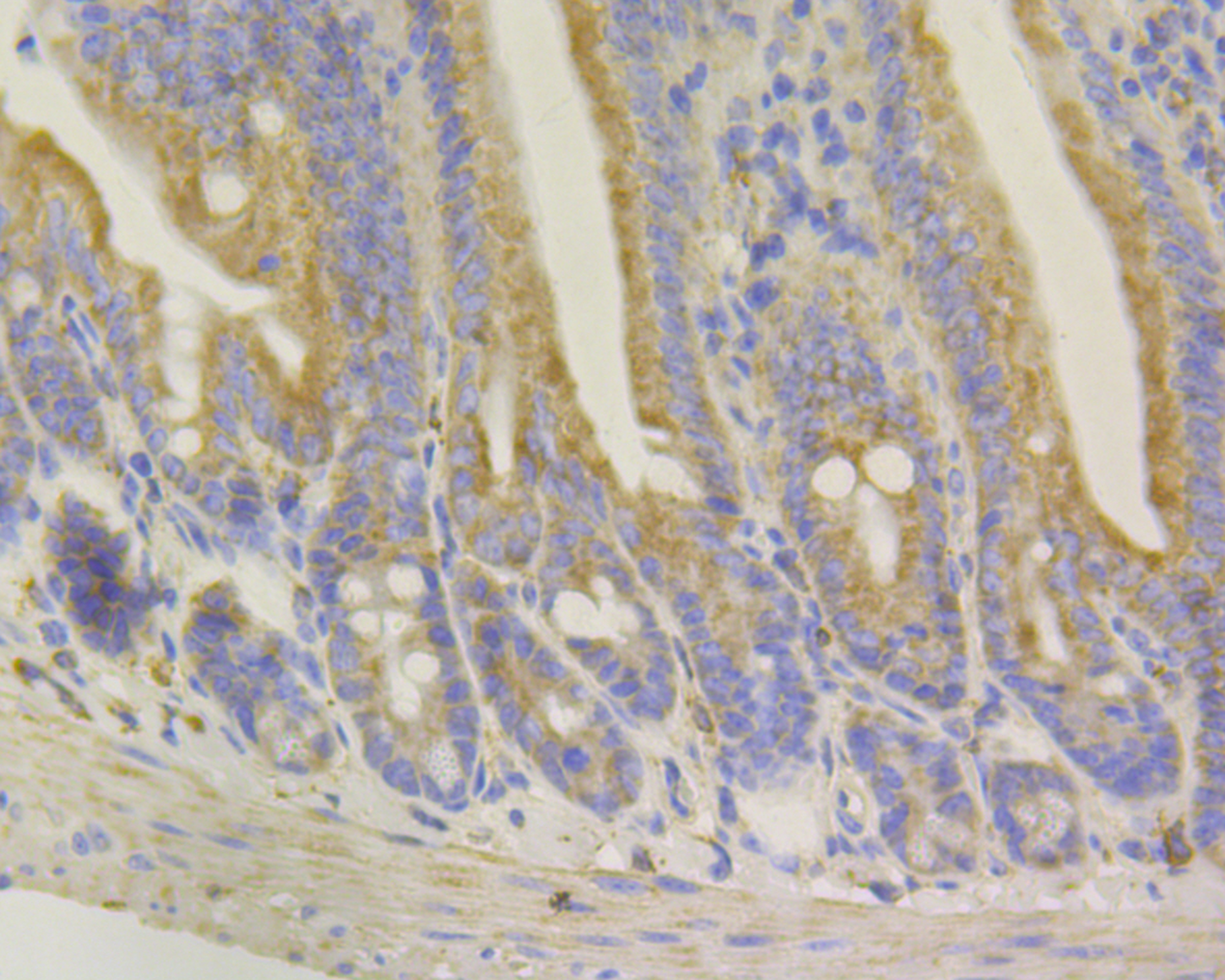 Syntrophin alpha 1 Rabbit mAb