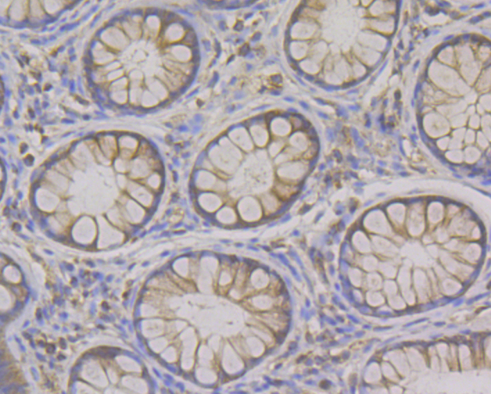 Syntrophin alpha 1 Rabbit mAb