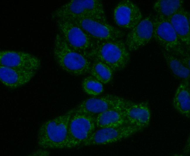 TREX1 Rabbit mAb