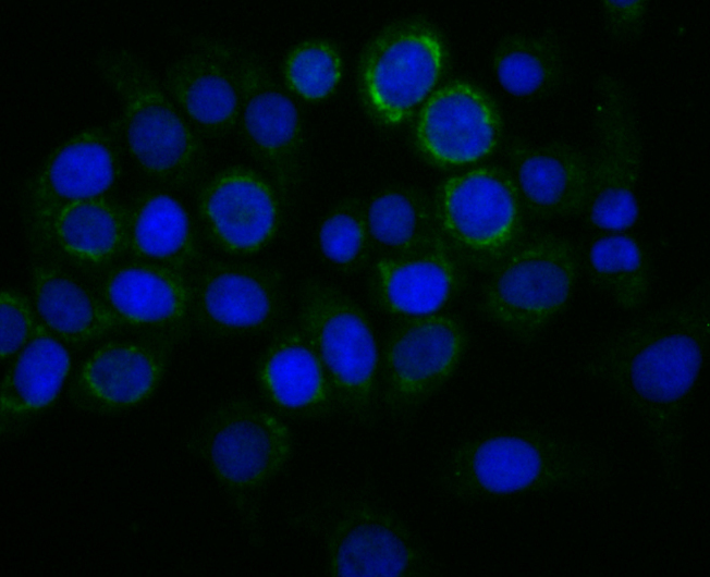 TREX1 Rabbit mAb