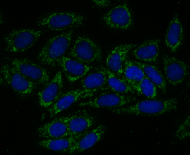 TREX1 Rabbit mAb