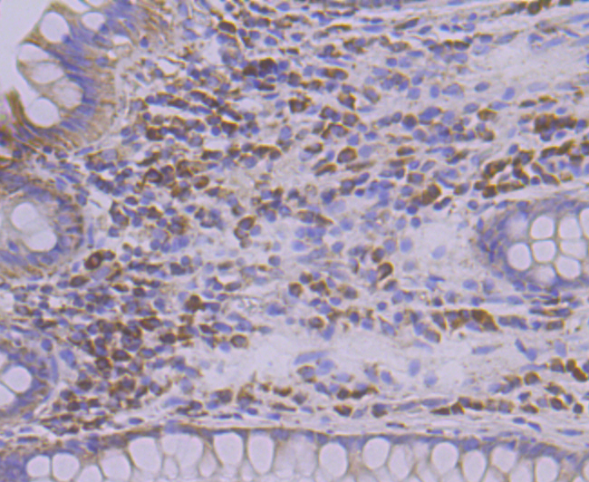 TREX1 Rabbit mAb