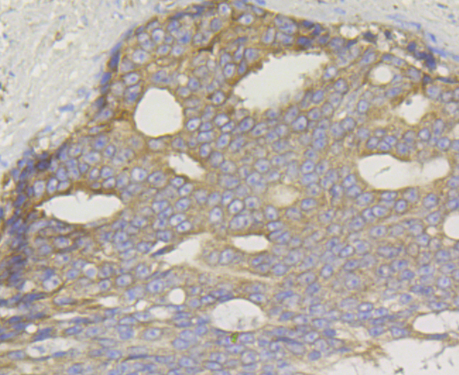 TREX1 Rabbit mAb