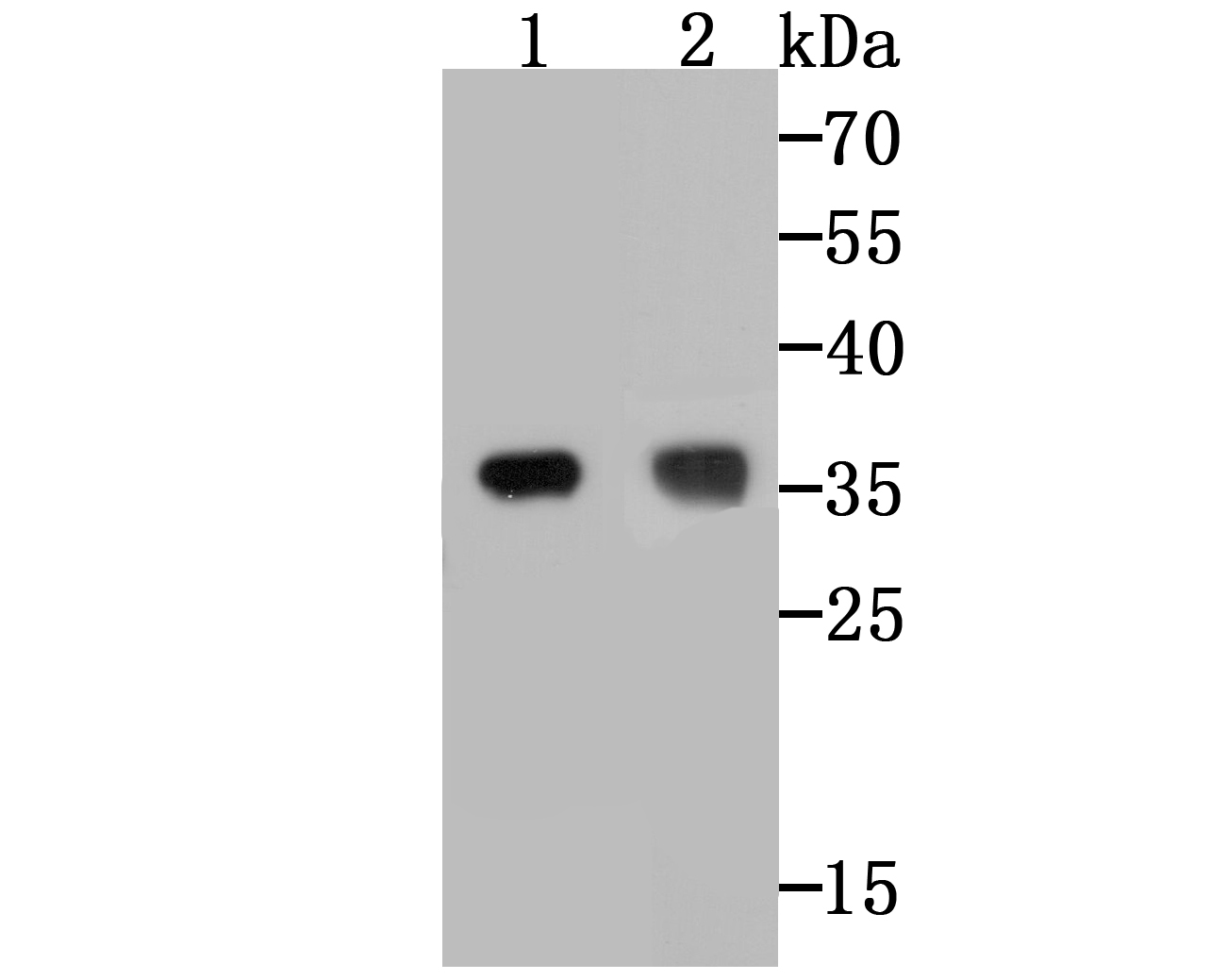 TREX1 Rabbit mAb