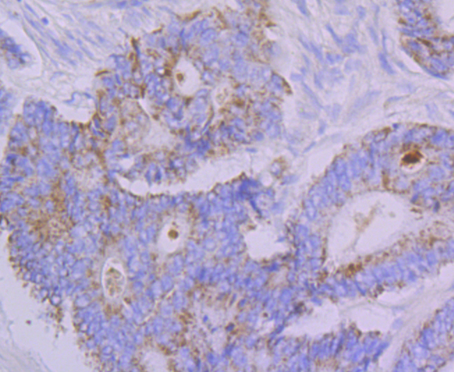 Emi1 Rabbit mAb