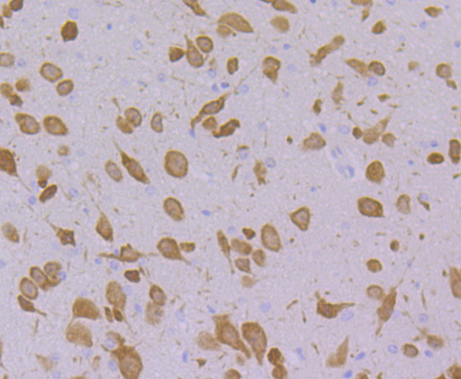 Emi1 Rabbit mAb