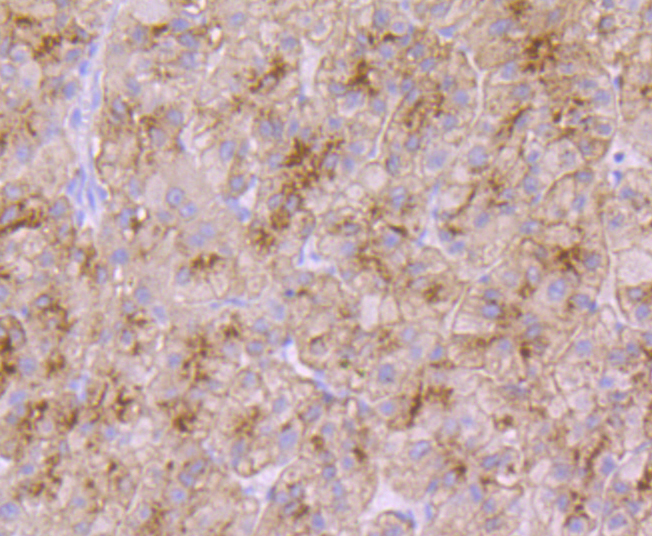 Transferrin Receptor 2 Rabbit mAb