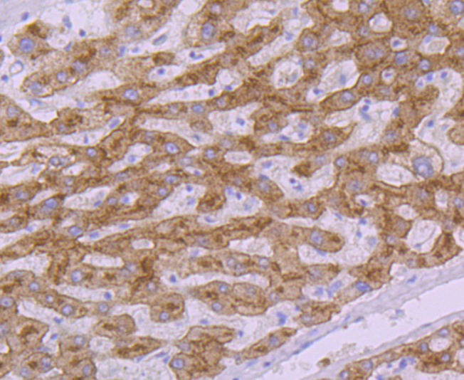 Transferrin Receptor 2 Rabbit mAb