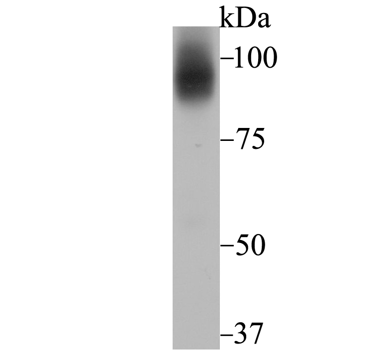 Transferrin Receptor 2 Rabbit mAb