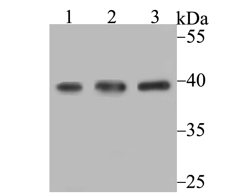 SAE1 Rabbit mAb