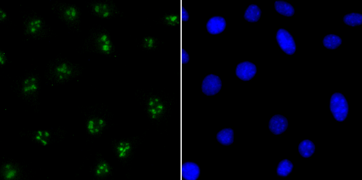 CENPC Rabbit mAb