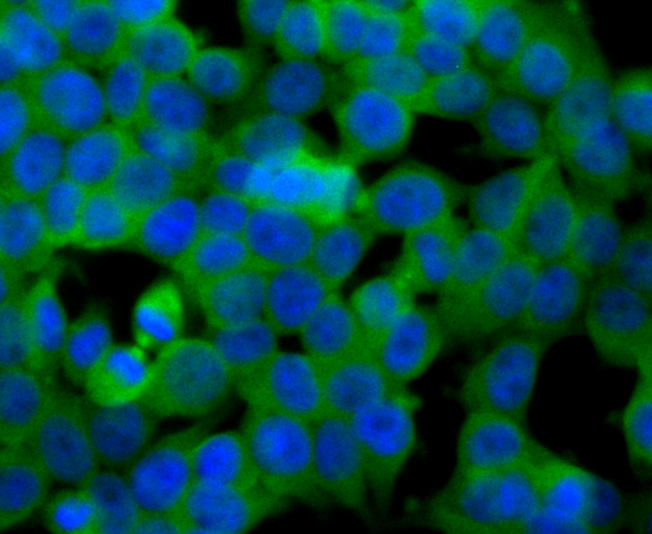 SULT2A1 Rabbit mAb