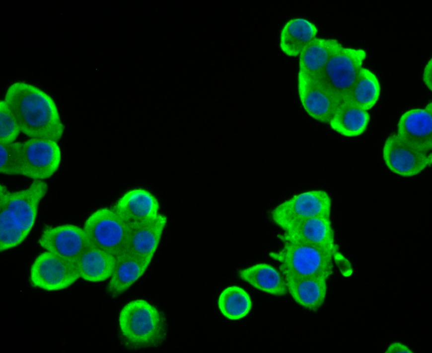 SULT2A1 Rabbit mAb