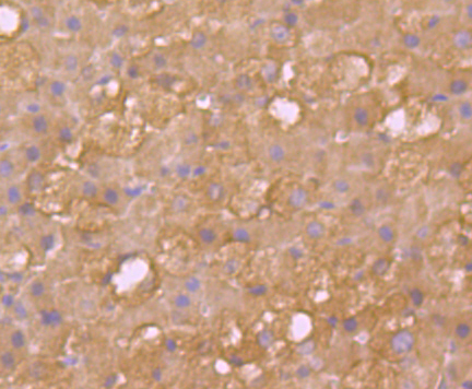 SULT2A1 Rabbit mAb