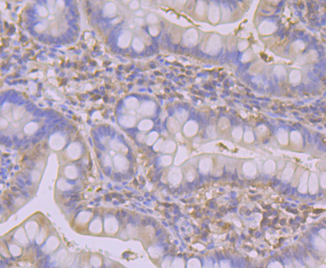 SULT2A1 Rabbit mAb