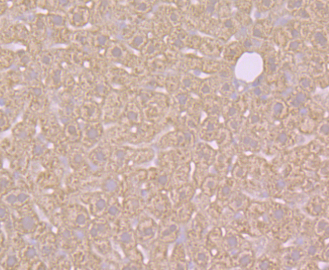 SULT2A1 Rabbit mAb