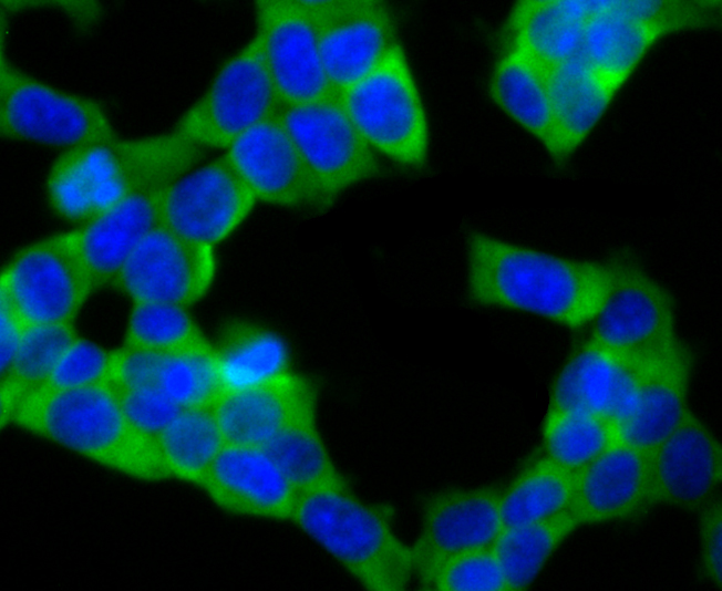 UQCRFS1 Rabbit mAb