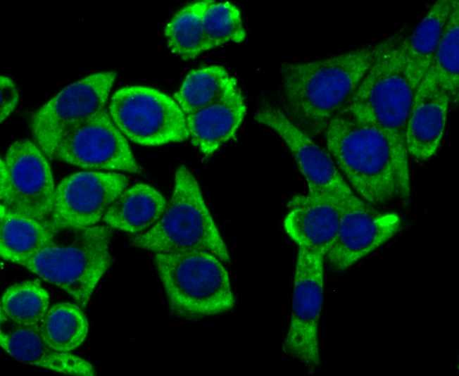 UQCRFS1 Rabbit mAb