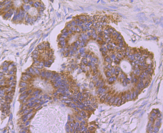 UQCRFS1 Rabbit mAb