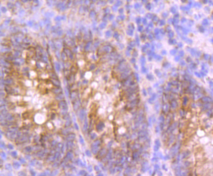 UQCRFS1 Rabbit mAb