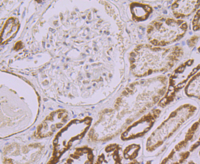 UQCRFS1 Rabbit mAb