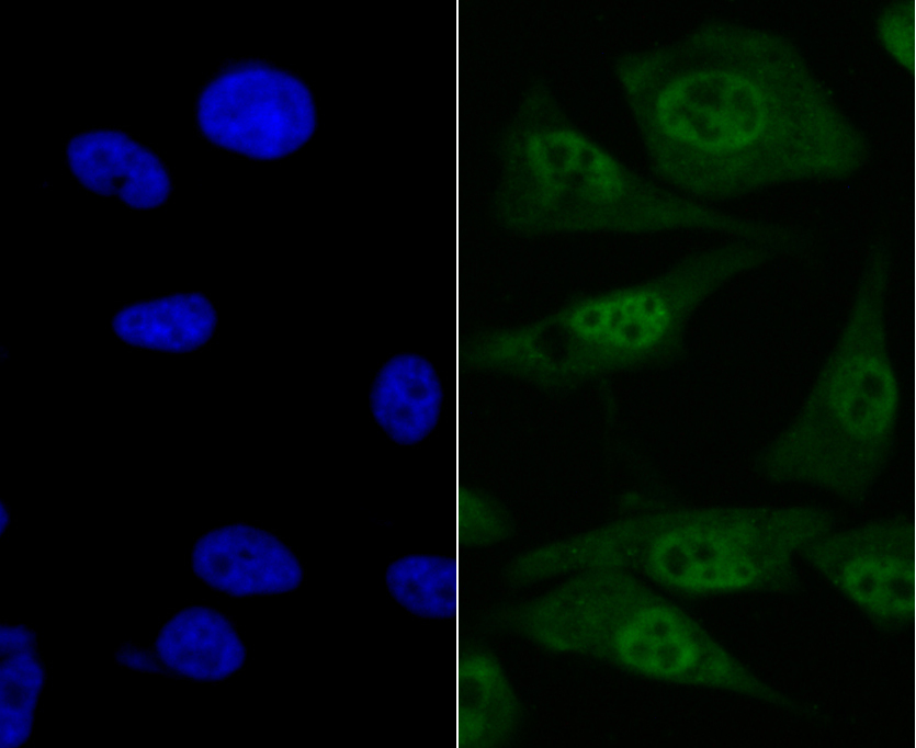 IRAK2 Rabbit mAb