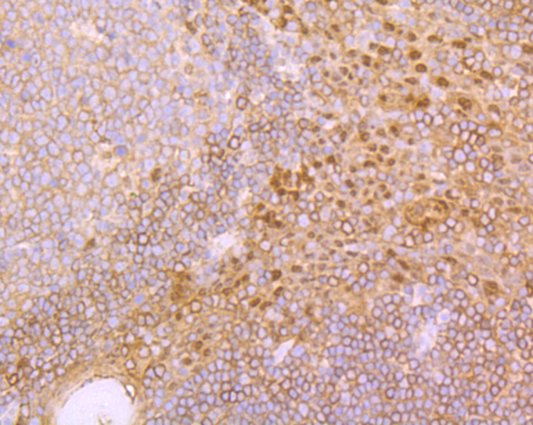 IRAK2 Rabbit mAb