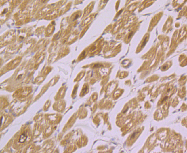 IRAK2 Rabbit mAb